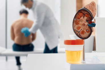 Uz galda stāv urīna parauga trauks un nieres anatomiskais modelis, bet ārsts izmeklē pacienta muguru medicīnas kabineta izplūdušajā fonā.